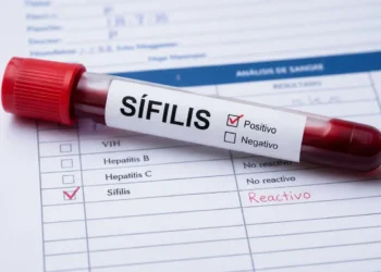 Sífilis en jóvenes: los diagnósticos crecieron casi un 25% entre 2024 y 2025