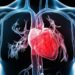 Cardiopatías en mujeres mexicanas: síntomas y factores de riesgo clave